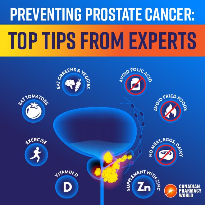 Preventing Prostate Cancer Top Tips From Experts 6953